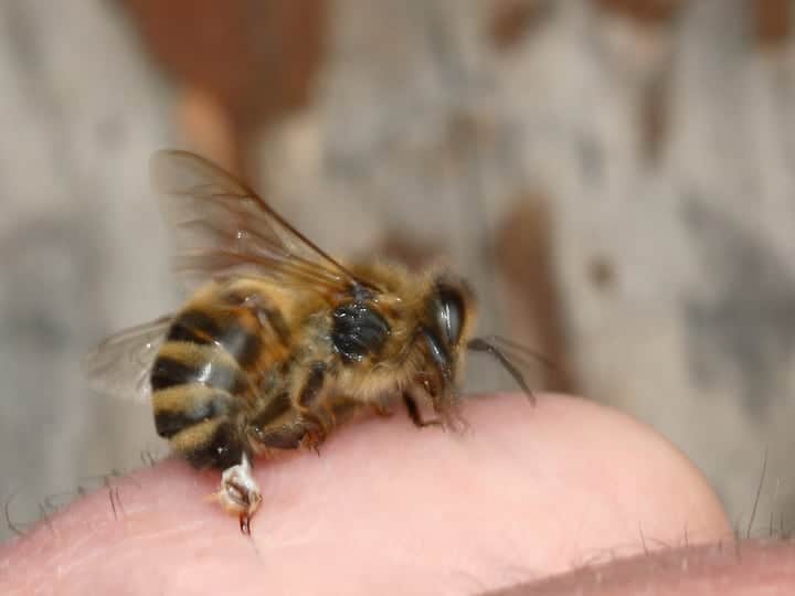 bee sting reaction